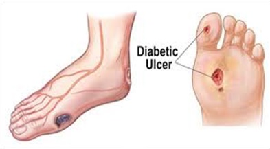 Diabetic Feet - Windsor \u0026 Maidenhead